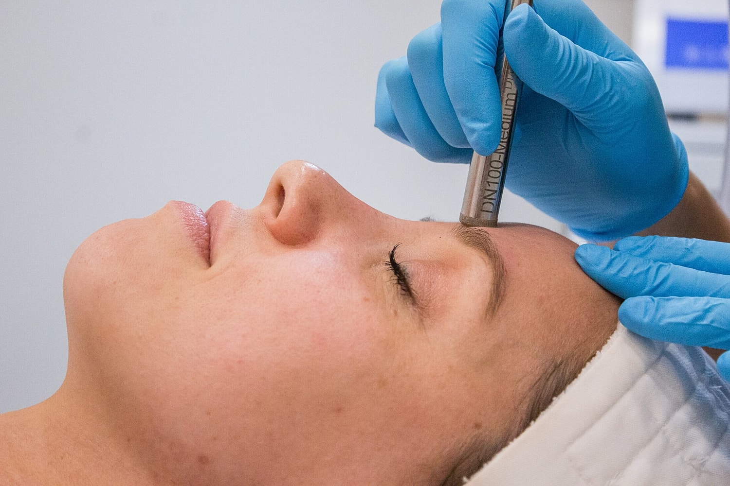 Microneedling Vs. Microdermabrasion