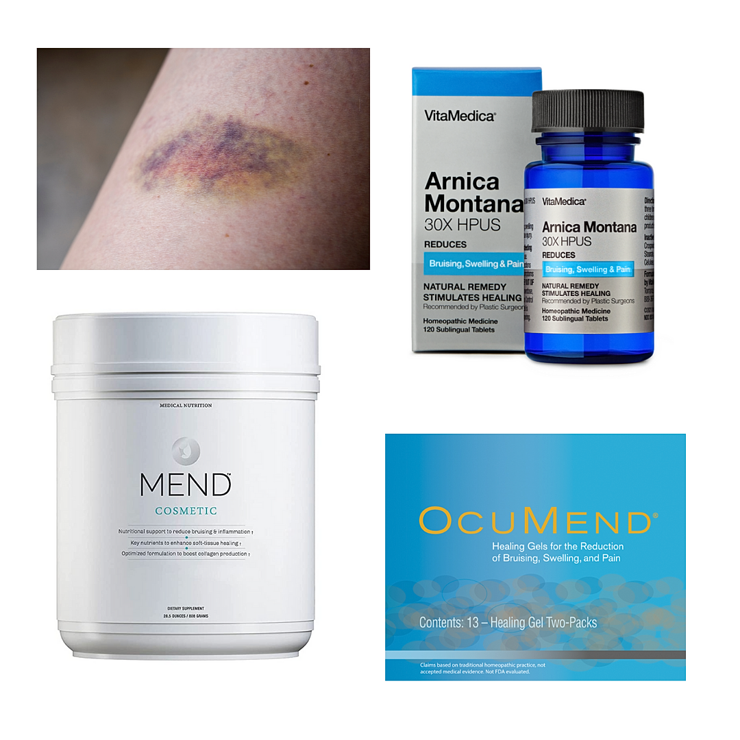 Tips to Decrease Bruising