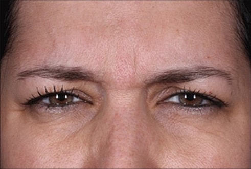 Close-up of woman's focused eyes and forehead.