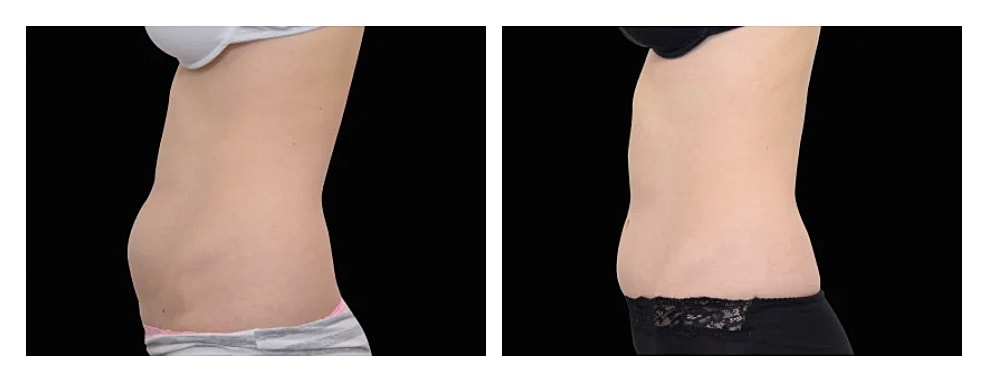 Comparison of body shapes from different angles.