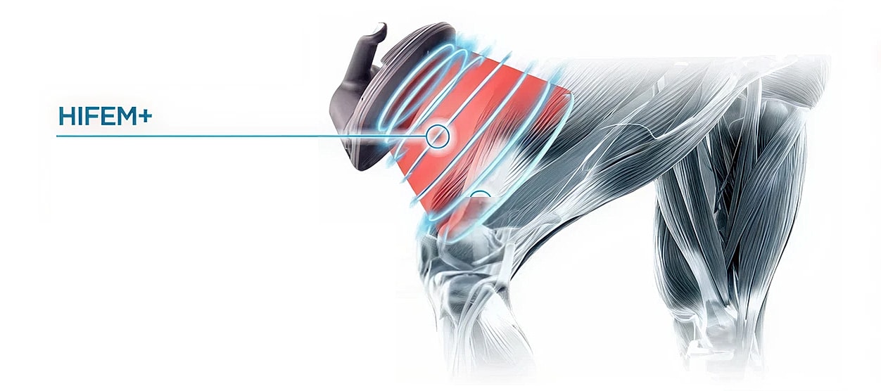 Emsculpt Neo how it works