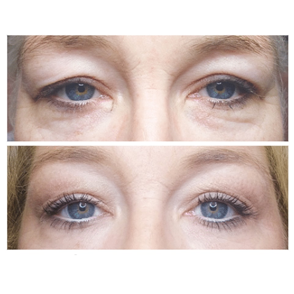 Before and after eye makeup transformation.