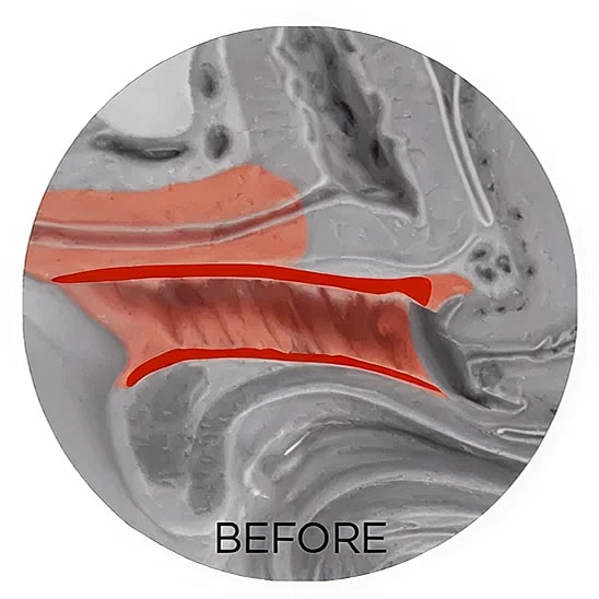 Visual comparison of surface texture, before enhancement.