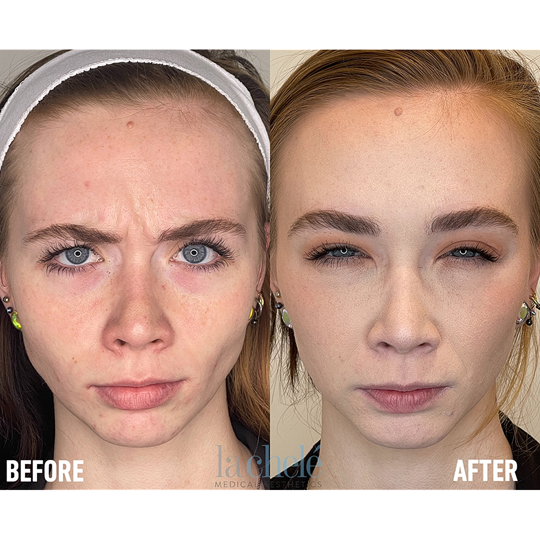 Before and after cosmetic treatment comparison.