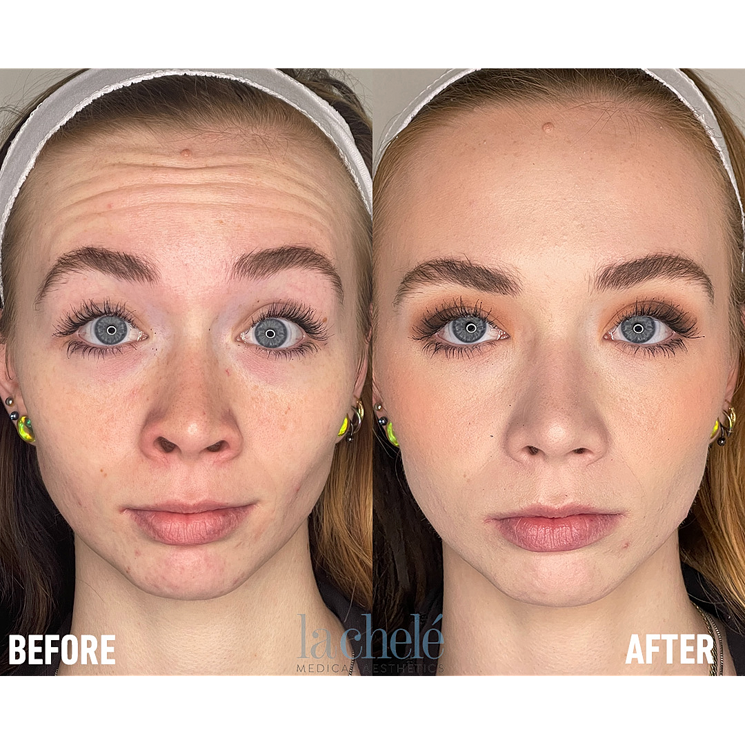 Before and after skincare transformation comparison.