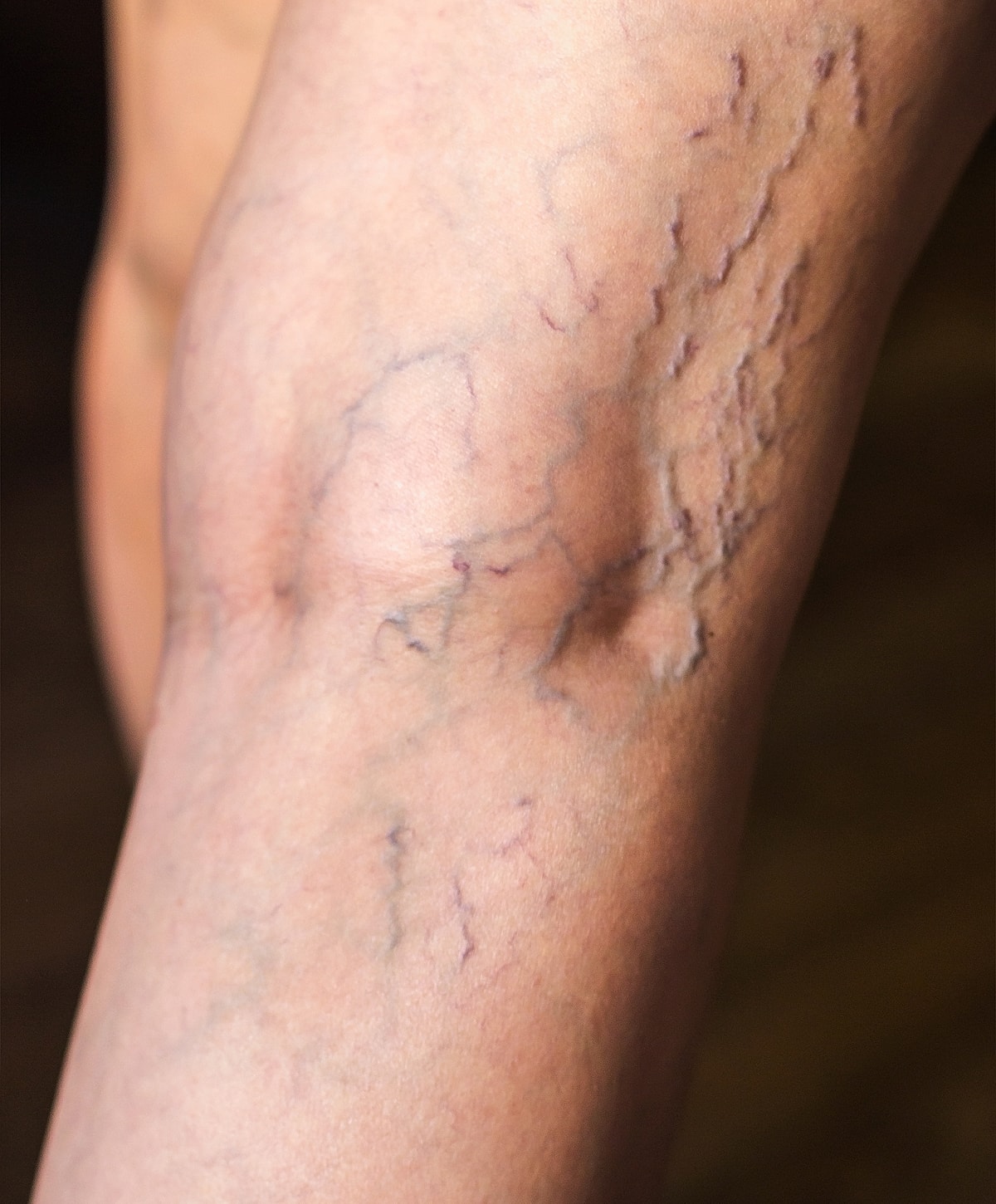 Medical professional preparing patient for procedure.