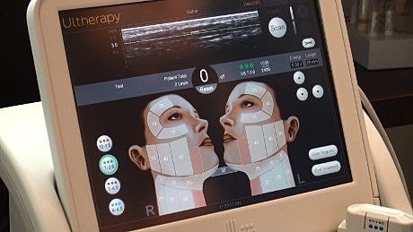 Ultherapy device screen showing treatment settings.