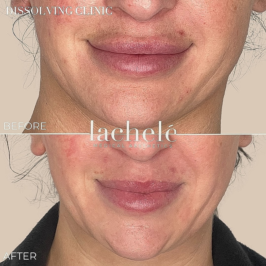 Before and after aesthetic treatment results.