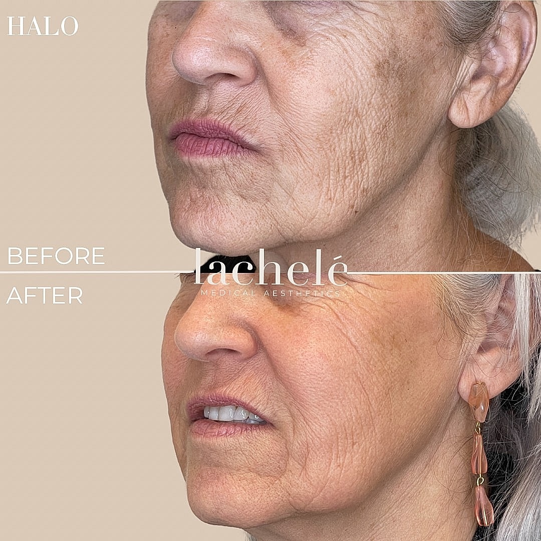 Before and after skin treatment results.