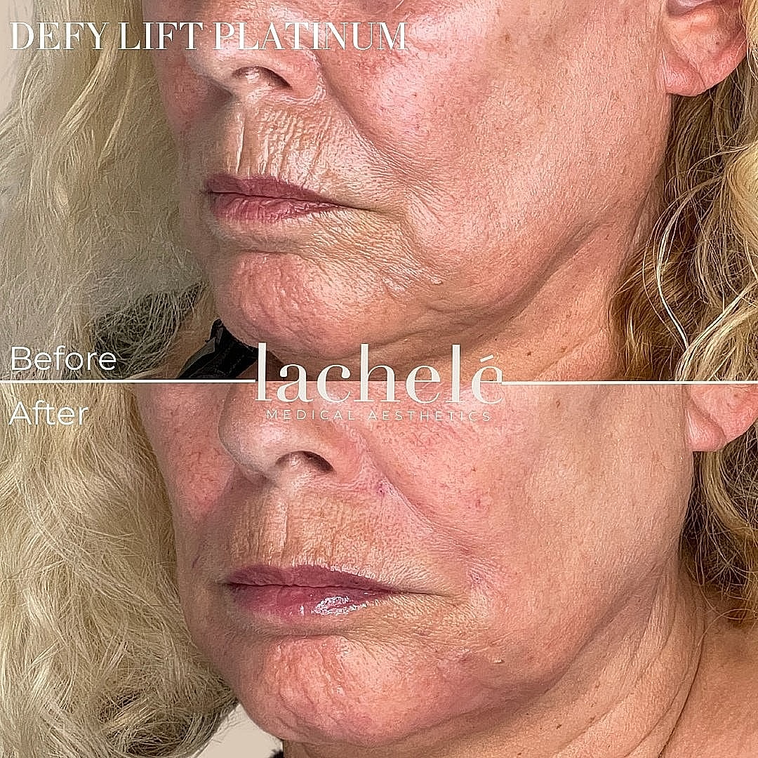 Before and after aesthetic treatment results