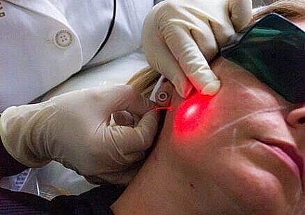 Laser skin treatment in a clinical setting