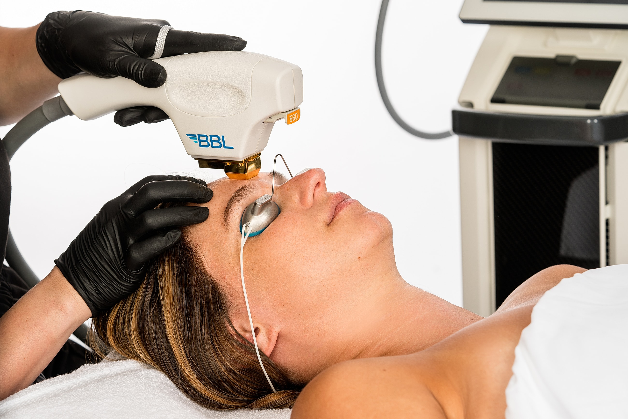 BBL treatment session on a woman's face.