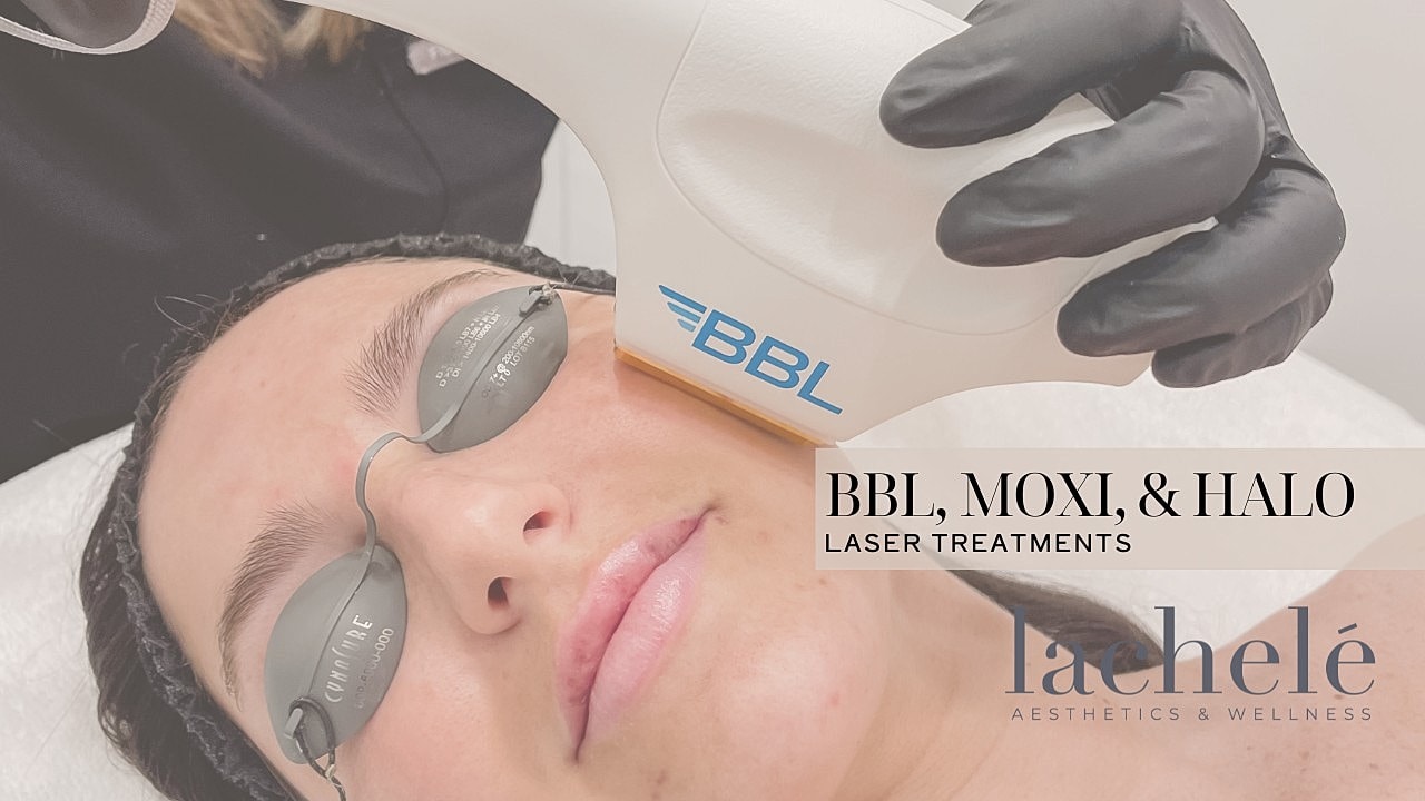 BBL laser treatment session at medical aesthetics clinic