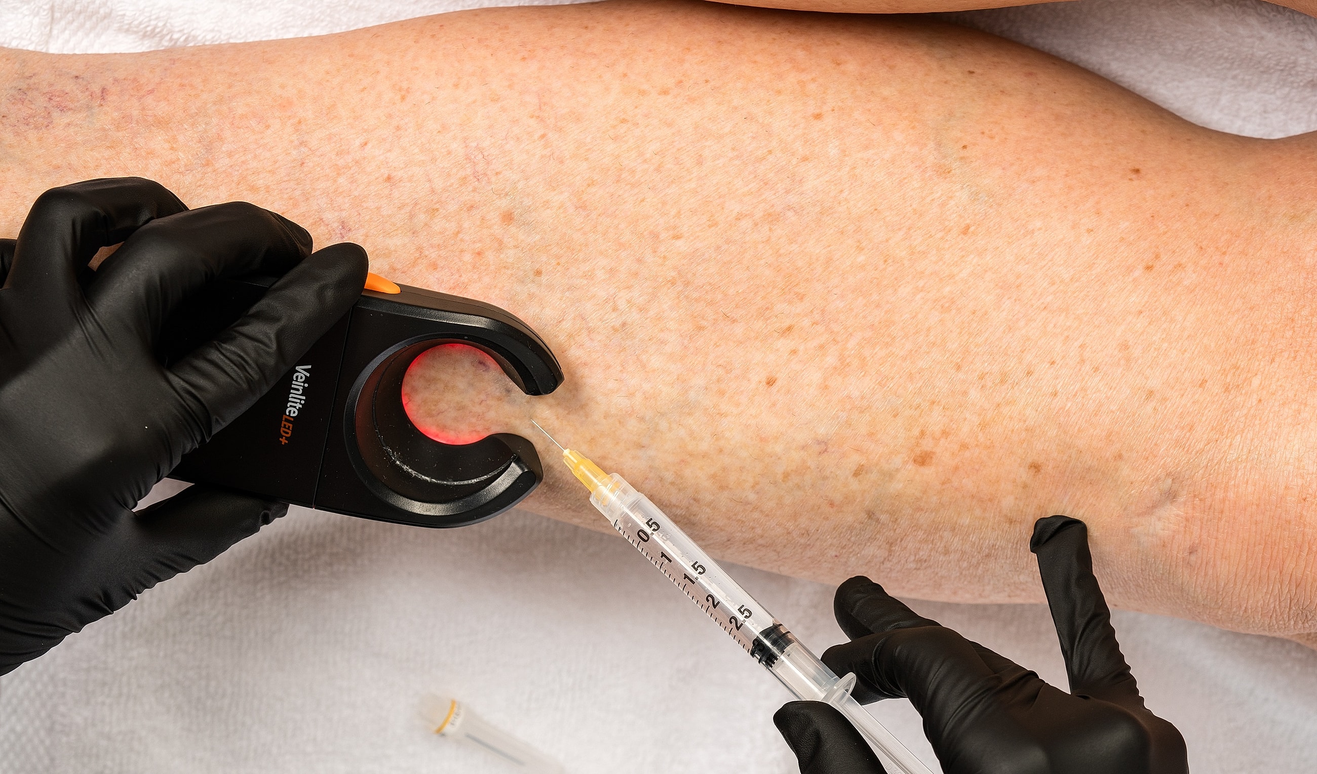 Close-up of legs showing skin imperfections.