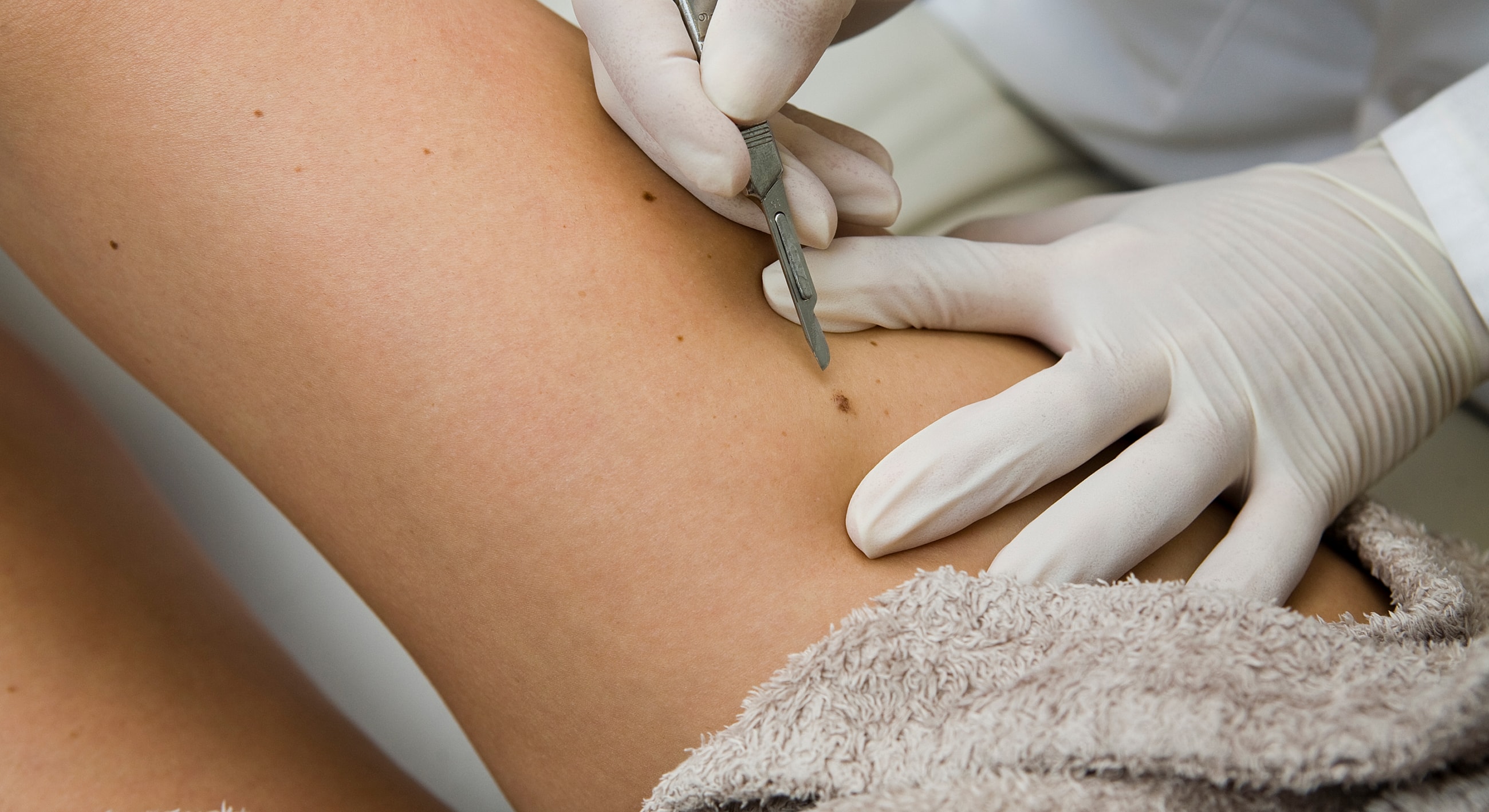 Skin examination procedure with a scalpel.